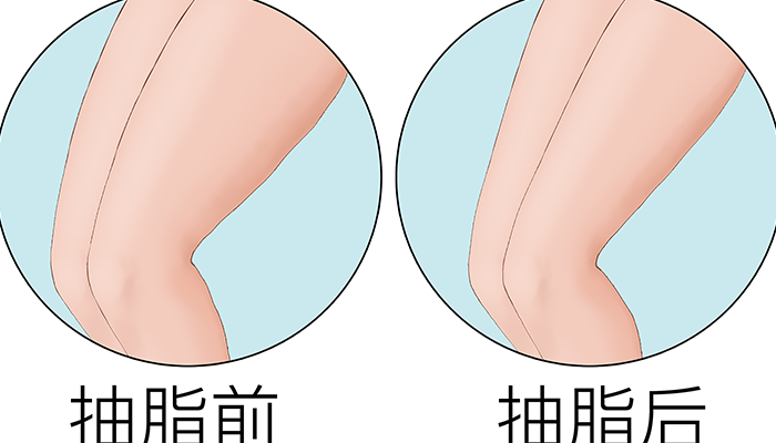 14.png